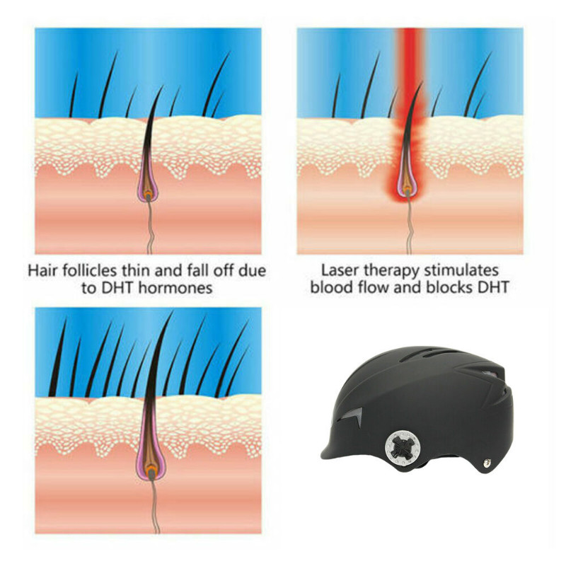 Therapy Hair Loss Regrowth /Growth Treat Helmet Alopecia Laser Cap 64 Diodes USA