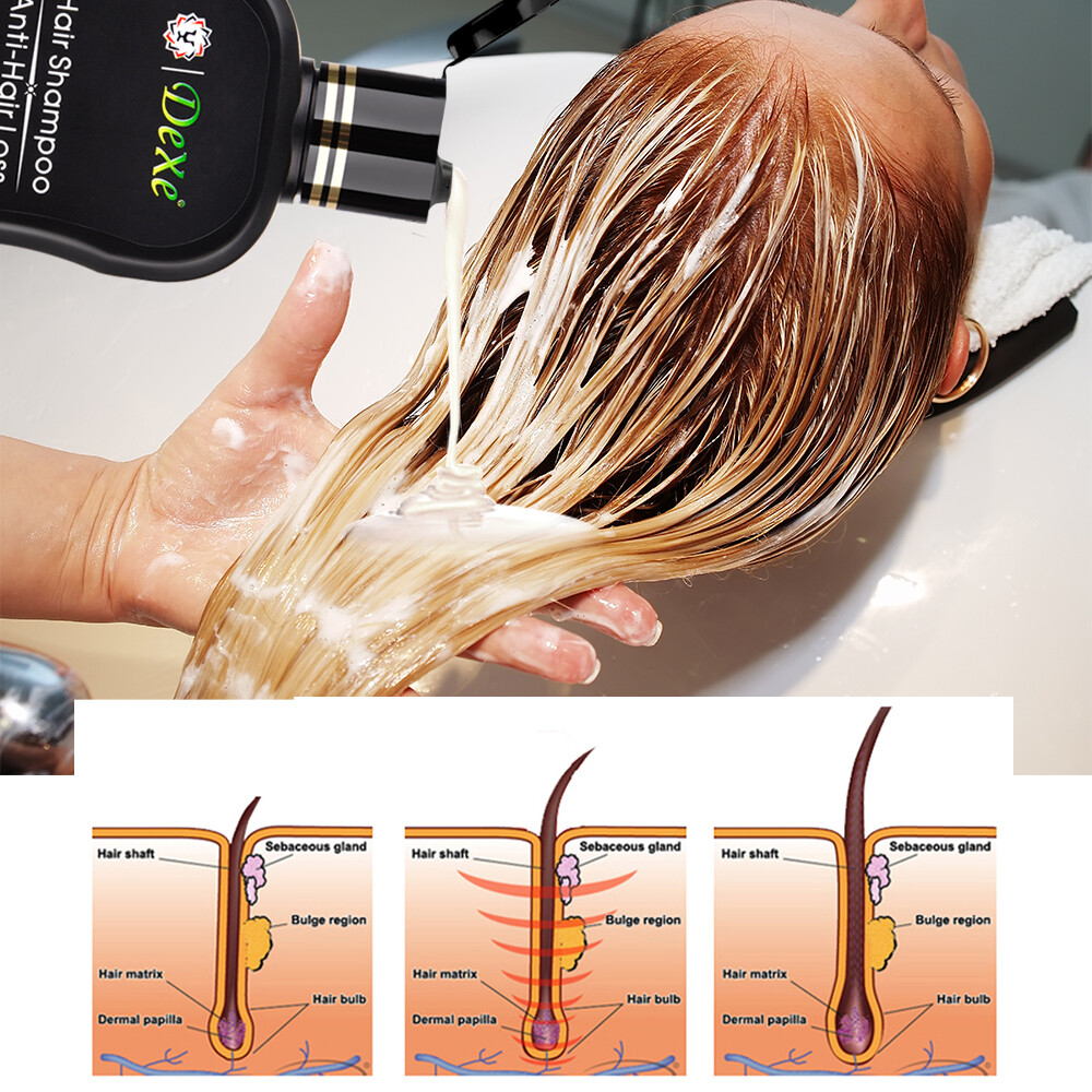 Anti Hair Loss Shampoo 200ML Hair Growth Treatment Care For Men & Women Herbal