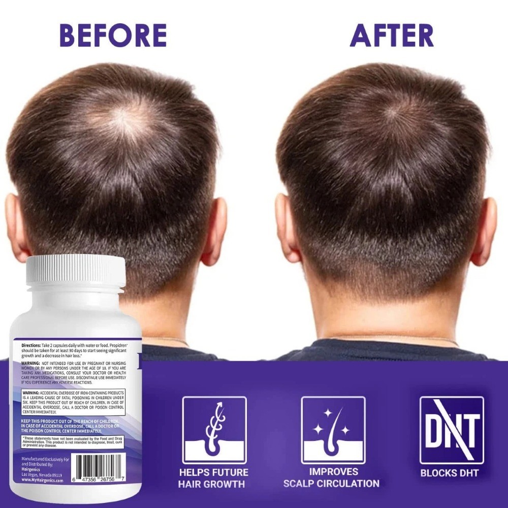 HairGenics Propidren – DHT blocks saw & palm to prevent hair loss-