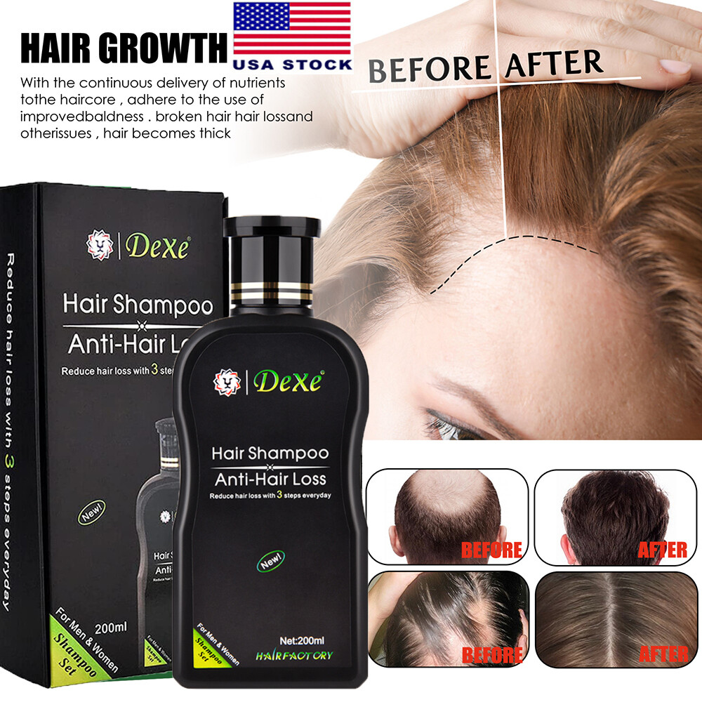 Anti Hair Loss Shampoo 200ML Hair Growth Treatment Care For Men & Women Herbal