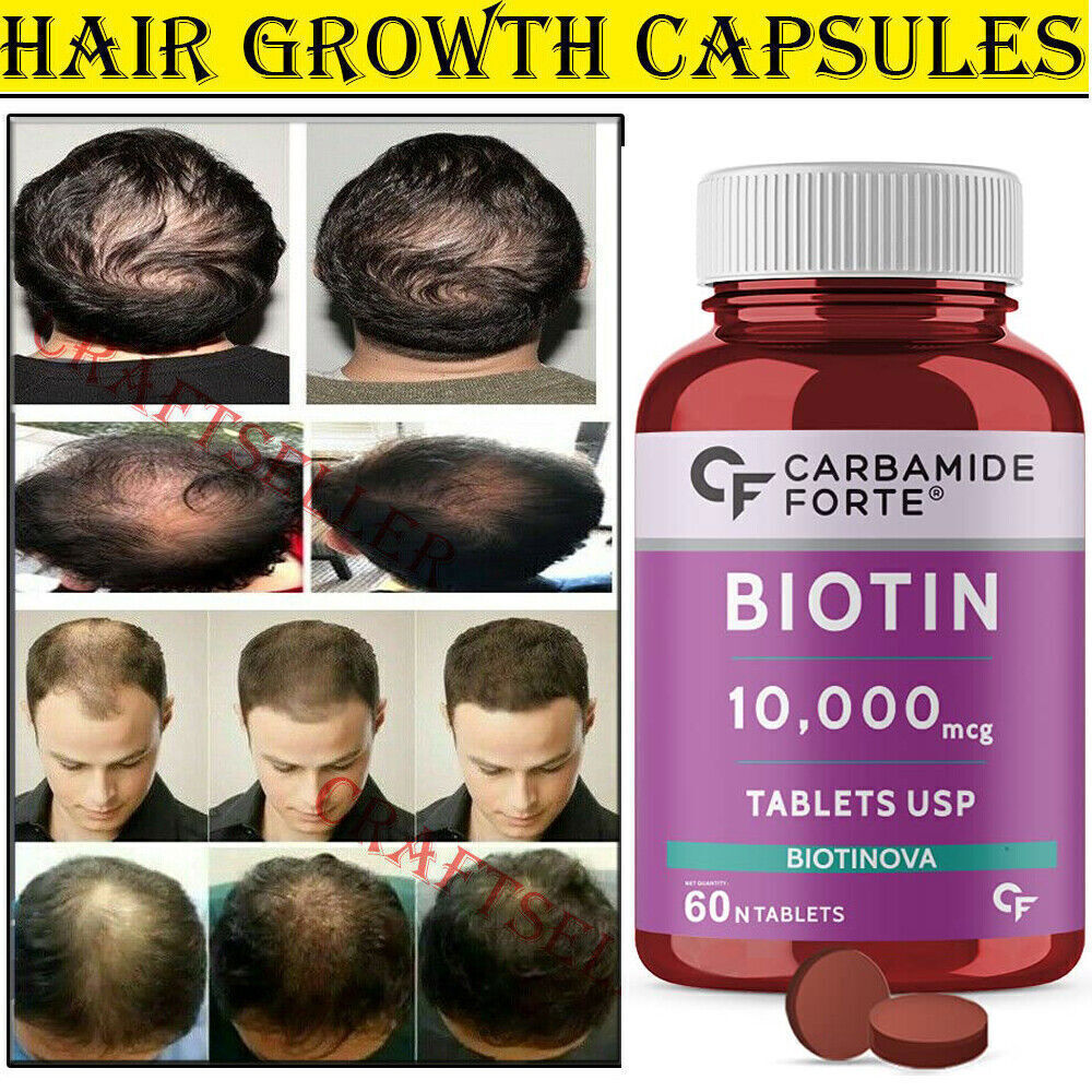 Viviscal Extra Strength Hair Growth Vitamin for Women Men Fast – 60 Tablets Pill