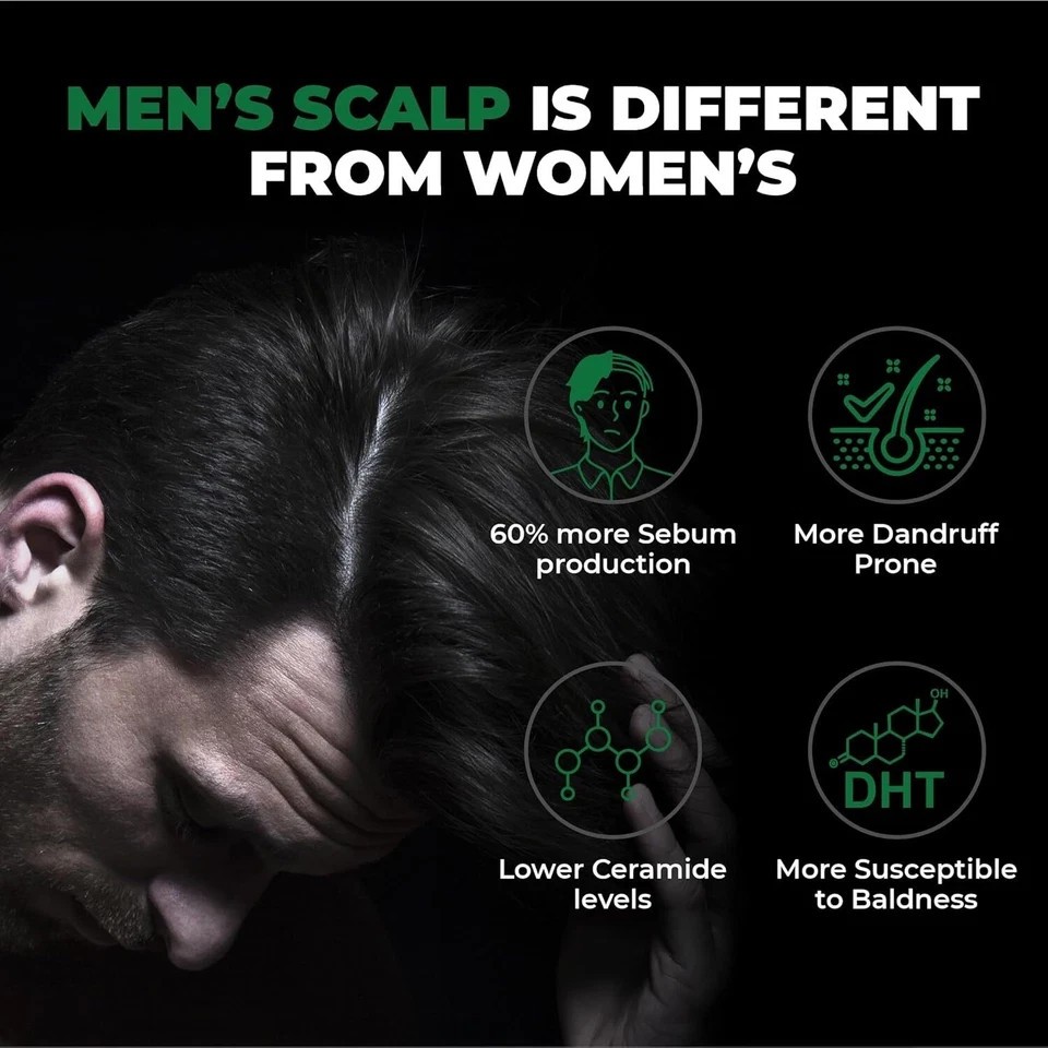 BEARDO Hair Loss Vegan Thickening Shampoo 200 Hair Loss Treatment Men and Women