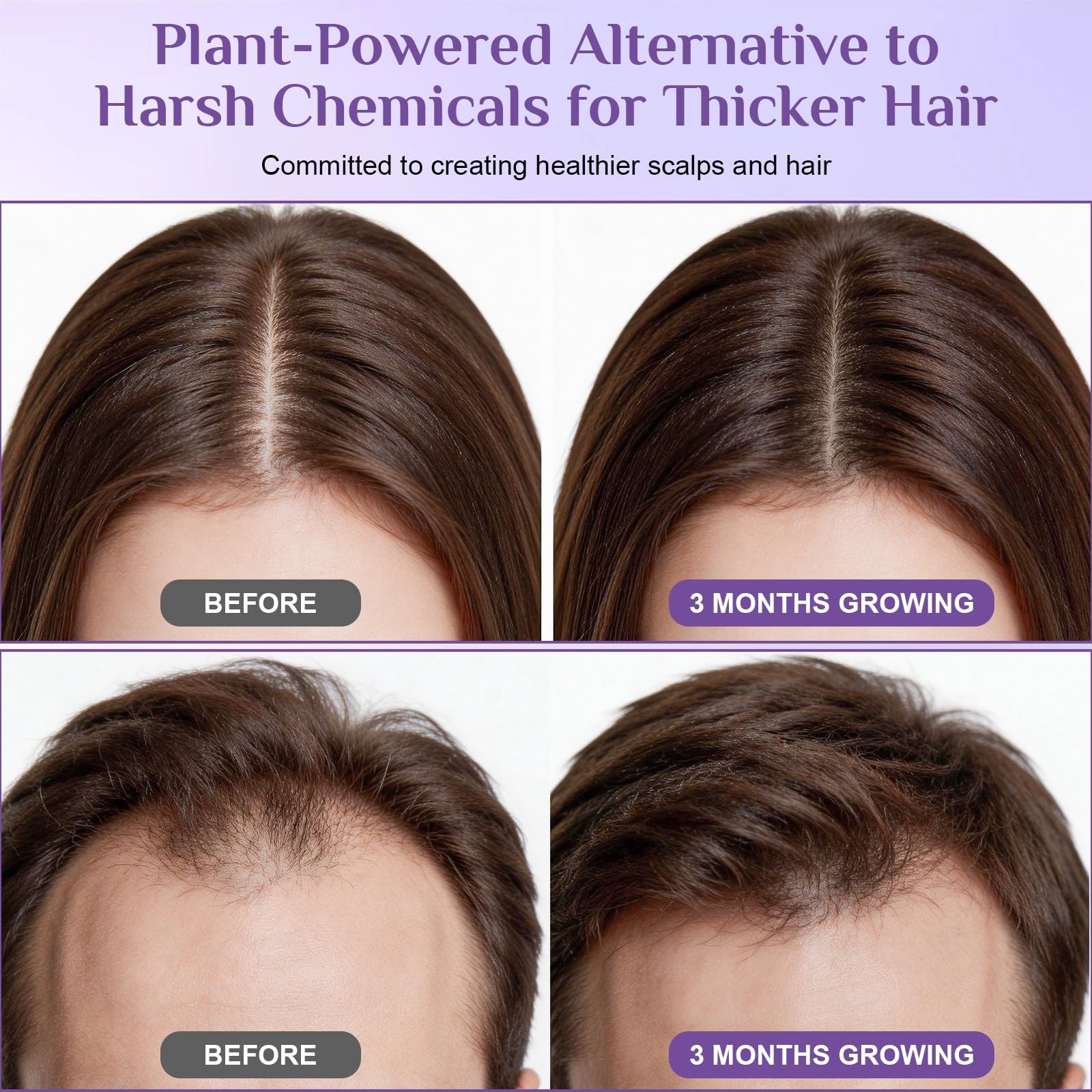 Rosemary Hair Growth Serum Roll-On | Rosemary Oil, Biotin, Anagain, Caffeine,…