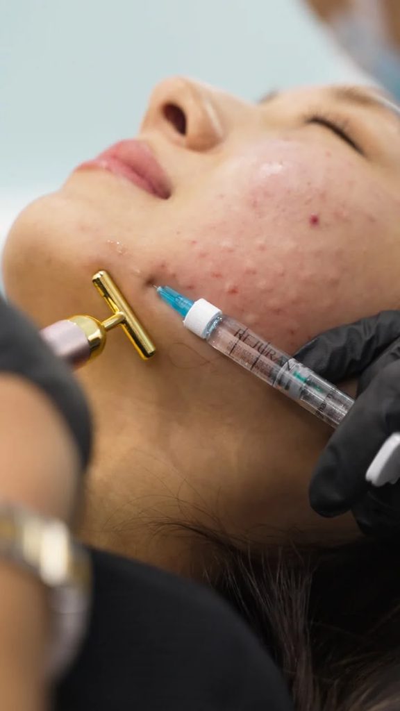 salmon dna injection